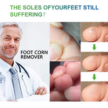 Load image into Gallery viewer, [Buy Toe Separator and Bunion corrector Online]-BetterToes