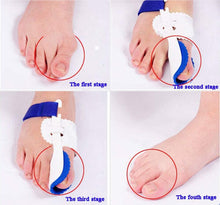 Load image into Gallery viewer, [Buy Toe Separator and Bunion corrector Online]-BetterToes