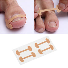 Load image into Gallery viewer, [Buy Toe Separator and Bunion corrector Online]-BetterToes