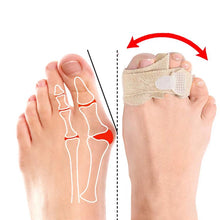 Load image into Gallery viewer, [Buy Toe Separator and Bunion corrector Online]-BetterToes