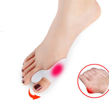Load image into Gallery viewer, [Buy Toe Separator and Bunion corrector Online]-BetterToes