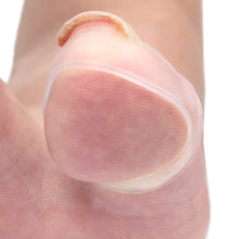 Load image into Gallery viewer, [Buy Toe Separator and Bunion corrector Online]-BetterToes