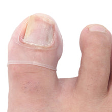 Load image into Gallery viewer, [Buy Toe Separator and Bunion corrector Online]-BetterToes