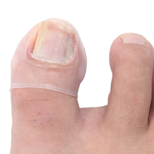 [Buy Toe Separator and Bunion corrector Online]-BetterToes